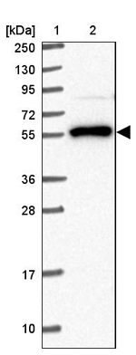 NACC2 Antibody in Western Blot (WB)