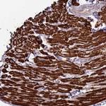 TRAPPC6B Antibody in Immunohistochemistry (Paraffin) (IHC (P))