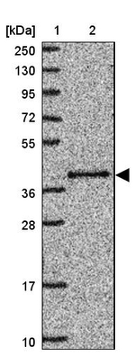 PRPF18 Antibody in Western Blot (WB)