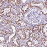 ACSS3 Antibody in Immunohistochemistry (Paraffin) (IHC (P))