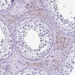 ACSS3 Antibody in Immunohistochemistry (Paraffin) (IHC (P))