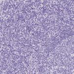 ACSS3 Polyclonal Antibody