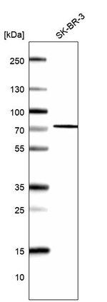 ACSS3 Antibody in Western Blot (WB)