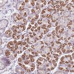 MOCOS Antibody in Immunohistochemistry (Paraffin) (IHC (P))