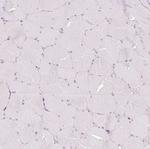 REEP6 Antibody in Immunohistochemistry (Paraffin) (IHC (P))