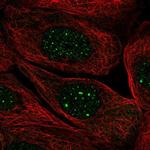 SIRPB2 Polyclonal Antibody