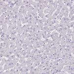 PLXNB3 Antibody in Immunohistochemistry (Paraffin) (IHC (P))