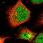 PLEKHG2 Polyclonal Antibody