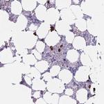 PLEKHG2 Antibody in Immunohistochemistry (Paraffin) (IHC (P))