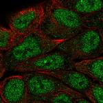 MUM1 Polyclonal Antibody