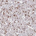 MUM1 Antibody in Immunohistochemistry (Paraffin) (IHC (P))