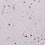 YLPM1 Antibody in Immunohistochemistry (Paraffin) (IHC (P))