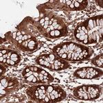 ZNF428 Polyclonal Antibody