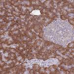 RPS10 Antibody in Immunohistochemistry (Paraffin) (IHC (P))