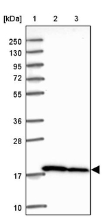 RPS10 Antibody in Western Blot (WB)