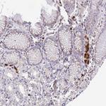 CSF3R Antibody in Immunohistochemistry (IHC)