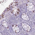 BLOC1S2 Polyclonal Antibody