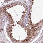 PDPR Polyclonal Antibody