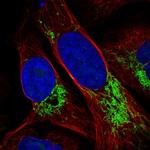 DDX49 Antibody in Immunocytochemistry (ICC/IF)