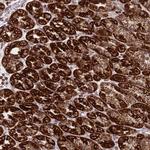 DDX49 Antibody in Immunohistochemistry (Paraffin) (IHC (P))