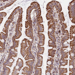 DDX49 Antibody in Immunohistochemistry (Paraffin) (IHC (P))