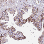 DDX49 Antibody in Immunohistochemistry (Paraffin) (IHC (P))
