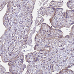 DDX49 Antibody in Immunohistochemistry (Paraffin) (IHC (P))