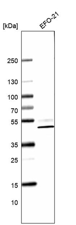 DDX49 Antibody in Western Blot (WB)