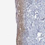 WDR22 Polyclonal Antibody
