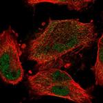 CCDC150 Polyclonal Antibody