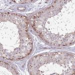 CCDC150 Antibody in Immunohistochemistry (IHC)