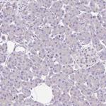 TDE1 Antibody in Immunohistochemistry (Paraffin) (IHC (P))