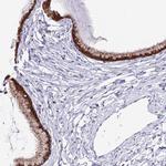 PRR15 Antibody in Immunohistochemistry (IHC)