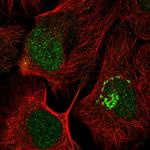 PFDN6 Antibody in Immunocytochemistry (ICC/IF)