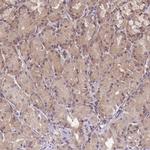 PFDN6 Antibody in Immunohistochemistry (IHC)