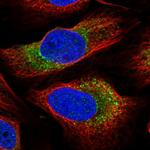 ARMCX6 Polyclonal Antibody