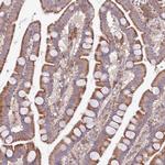 ARMCX6 Antibody in Immunohistochemistry (Paraffin) (IHC (P))