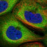 TMCO3 Polyclonal Antibody