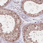 VPS52 Polyclonal Antibody