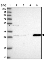 GSTO2 Antibody in Western Blot (WB)