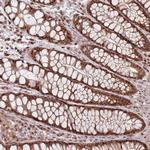 WDR55 Antibody in Immunohistochemistry (Paraffin) (IHC (P))