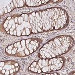 KIAA1191 Antibody in Immunohistochemistry (Paraffin) (IHC (P))