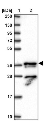 KIAA1191 Antibody in Western Blot (WB)