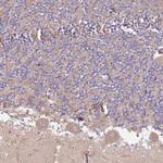 SPDL1 Antibody in Immunohistochemistry (Paraffin) (IHC (P))