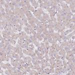 SPDL1 Antibody in Immunohistochemistry (Paraffin) (IHC (P))