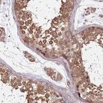 SPDL1 Antibody in Immunohistochemistry (IHC)