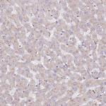 SPDL1 Antibody in Immunohistochemistry (IHC)