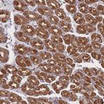 PSMB3 Antibody in Immunohistochemistry (Paraffin) (IHC (P))