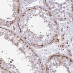 KIAA1211 Antibody in Immunohistochemistry (IHC)