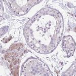 WDR70 Polyclonal Antibody